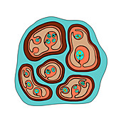 Echinococcus multilocularis hydatid cyst, illustration