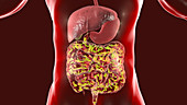 Normal flora of human intestine, conceptual illustration