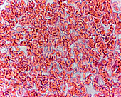 Red blood cells, light micrograph