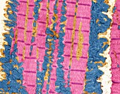 Striated muscle, TEM