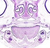 Embryo head, light micrograph