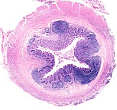 Human appendix, light micrograph