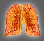 Healthy lungs, CT scan