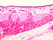 Human lingual tonsil, light micrograph