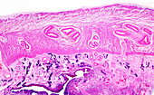 Human cervix, light micrograph