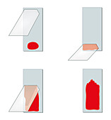 Blood smear preparation technique, illustration