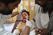 Burns treatment, Afghanistan