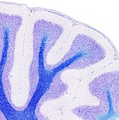 Human cerebellum, light micrograph