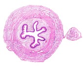 Oesophagus, light micrograph