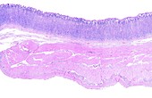 Layers of stomach wall, light micrograph