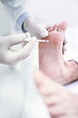 Botox injection in feet