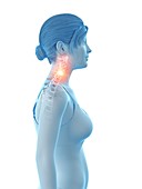 Woman with a painful neck, illustration