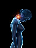 Woman with a painful neck, illustration