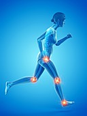 Woman with painful joints while running, illustration