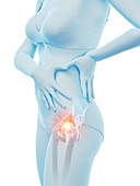 Woman with a painful hip, illustration