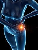 Woman with a painful hip, illustration