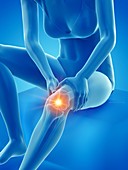 Woman with a painful knee, illustration