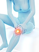 Woman with a painful knee, illustration