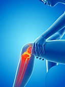 Woman with a painful knee, illustration