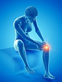 Woman with a painful knee, illustration