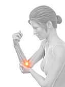 Woman with a painful elbow, illustration