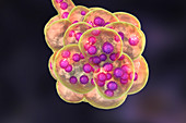 Coronavirus disease of the lungs, conceptual illustration