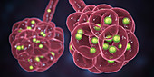 Coronavirus disease of the lungs, conceptual illustration