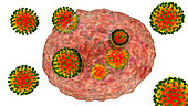 Covid-19 coronaviruses infecting human cells, illustration