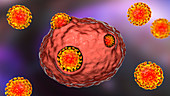 Covid-19 coronaviruses infecting human cells, illustration