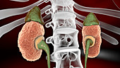 Chronic kidney disease, illustration