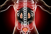 Chronic kidney disease, illustration