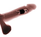 Motorised vibrator, X-ray