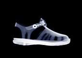 Children's jelly shoe, X-ray