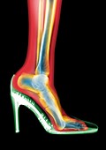 Leg in stiletto shoe MRI style, X-ray