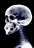 Human skull and neck, X-ray