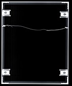 Picture frame, X-ray
