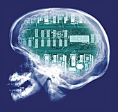 Human skull and computer circuit board, X-ray