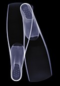 Snorkelling flippers, X-ray