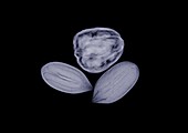 Assorted nuts, X-ray