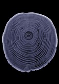 Tree trunk cross section, X-ray