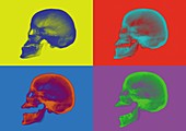Four skulls against coloured backgrounds, X-ray