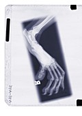 Animal claw, X-ray