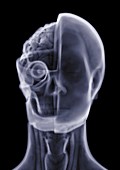 Anatomical model, X-ray