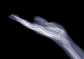 Hand with an open palm, X-ray