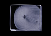 Toilet paper in packaging, X-ray