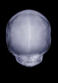 Human skull rear view, X-ray