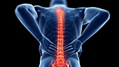Human back pain