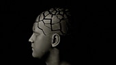 Brain cancer, conceptual animation