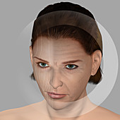 Skin aging, illustration