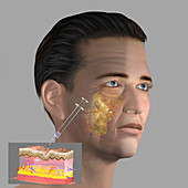 Skin aging, illustration